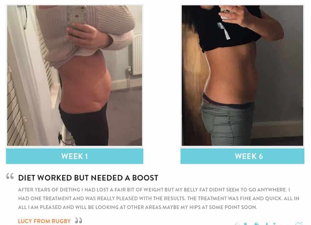 Before and After Dieting Worksop