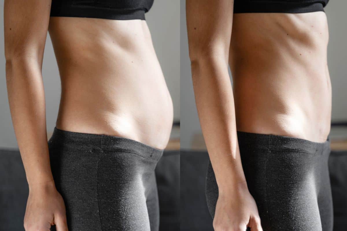 Post-Pregnancy: What Happens to Your Abdominal Muscles After Birth Worksop