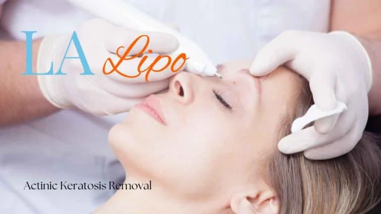 Woman receiving Actinic Keratosis Removal Treatment Worksop
