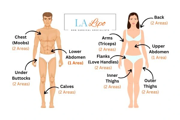 LA LIPO Cryolipolysis Areas Worksop