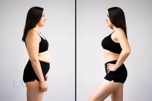 link between body image and mental health Worksop