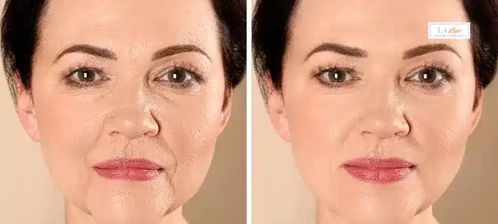 Why Aren’t My Skincare Products Making My Sagging Skin Look Firmer Worksop?