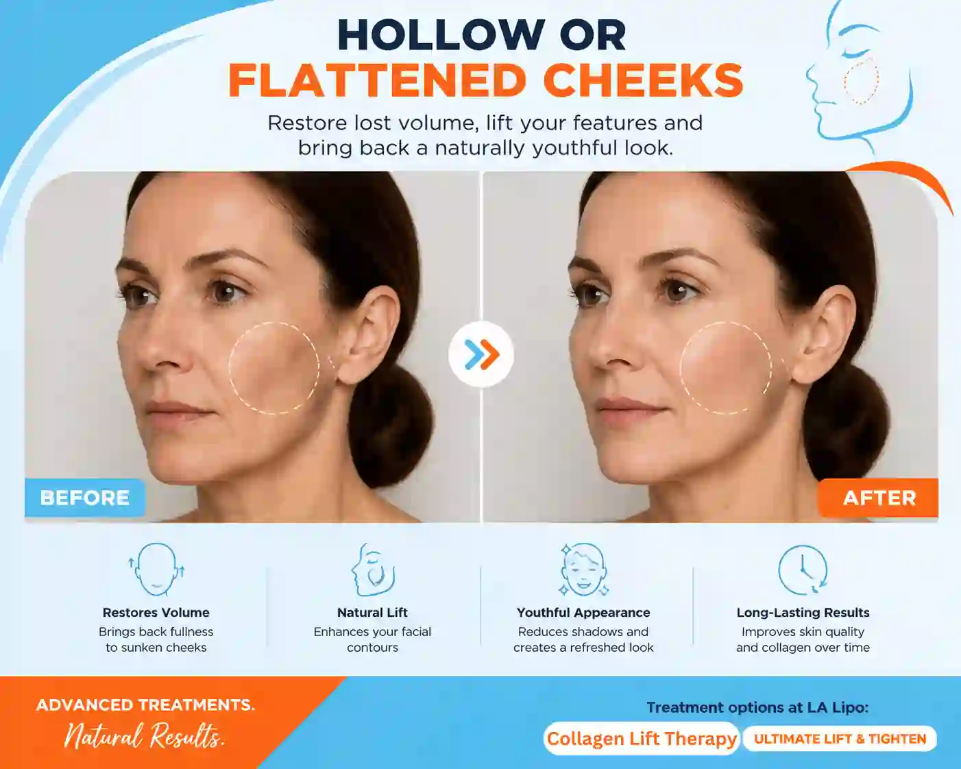 Sign #4: Hollow or Flattened Cheeks Worksop
