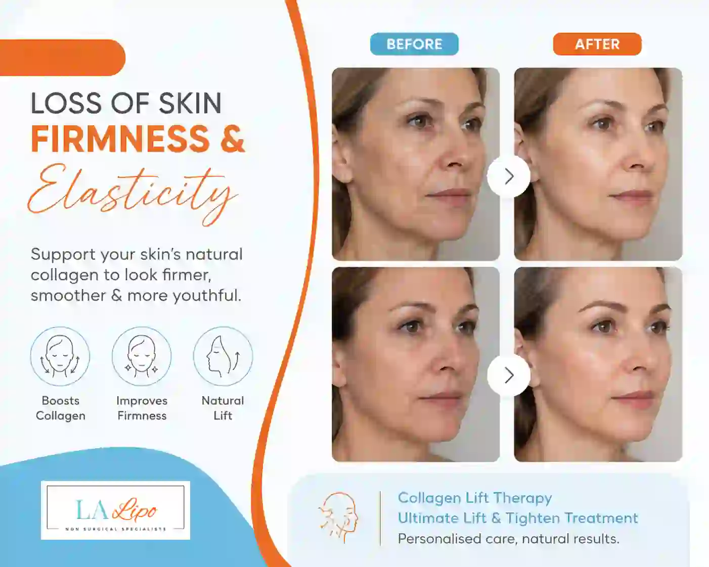 Sign #7: Loss of Skin Firmness and Elasticity Worksop