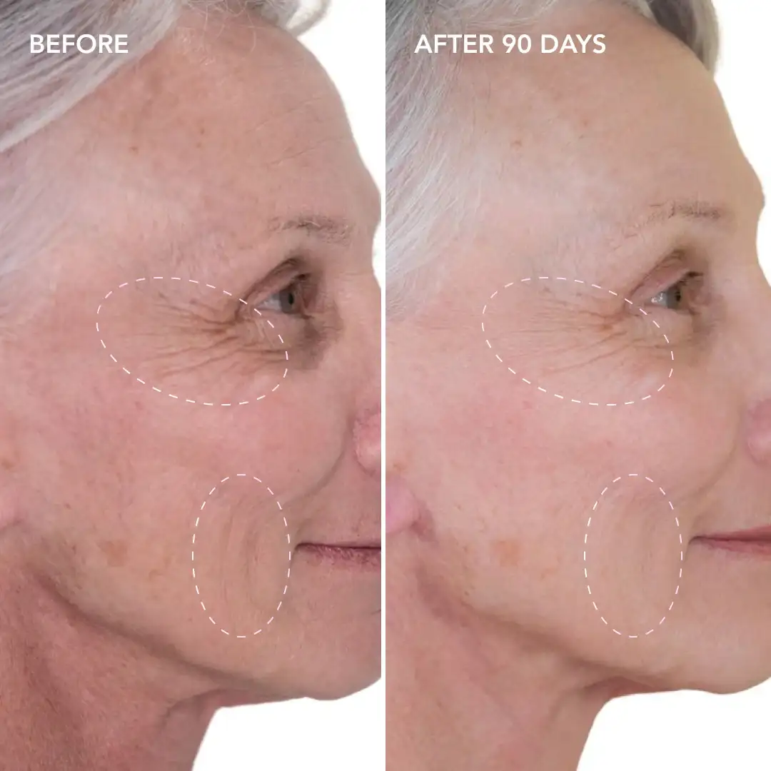 When will you see results Worksop
